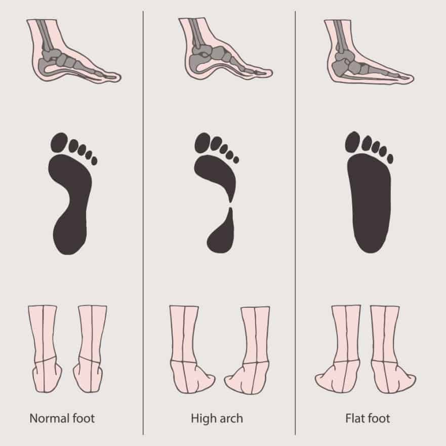 different types of feet