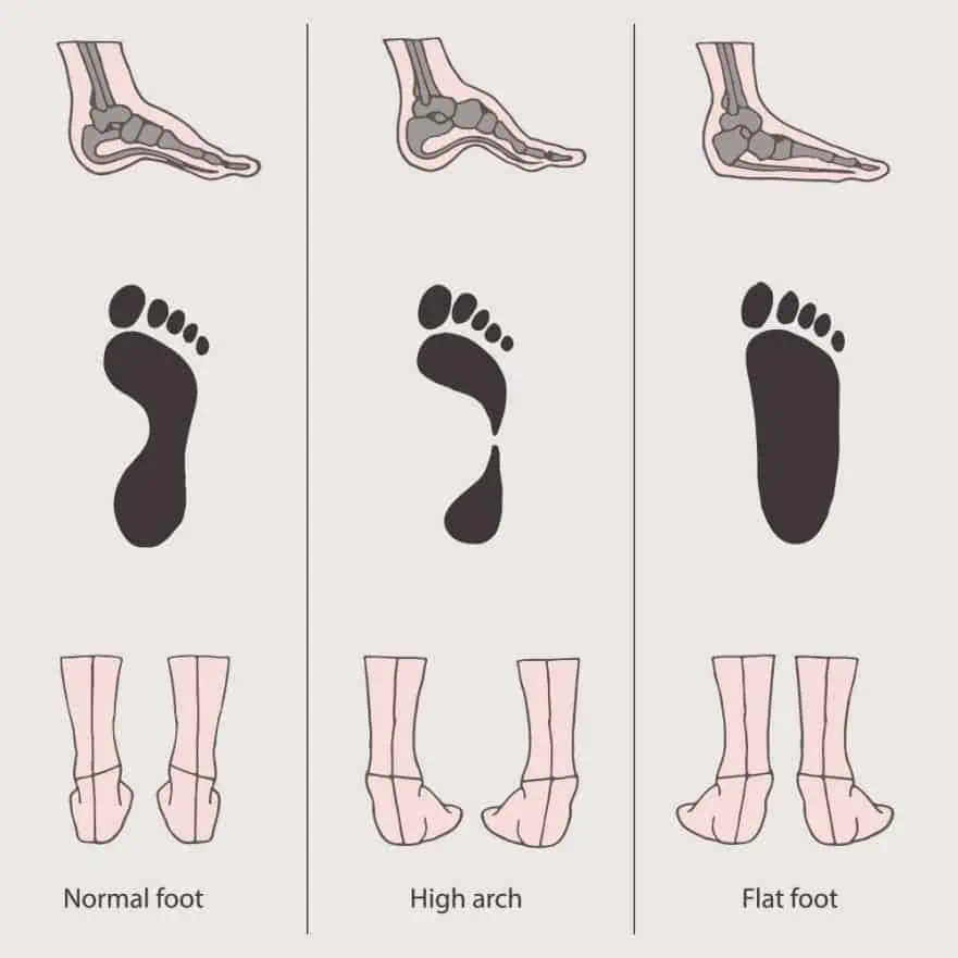 different types of feet